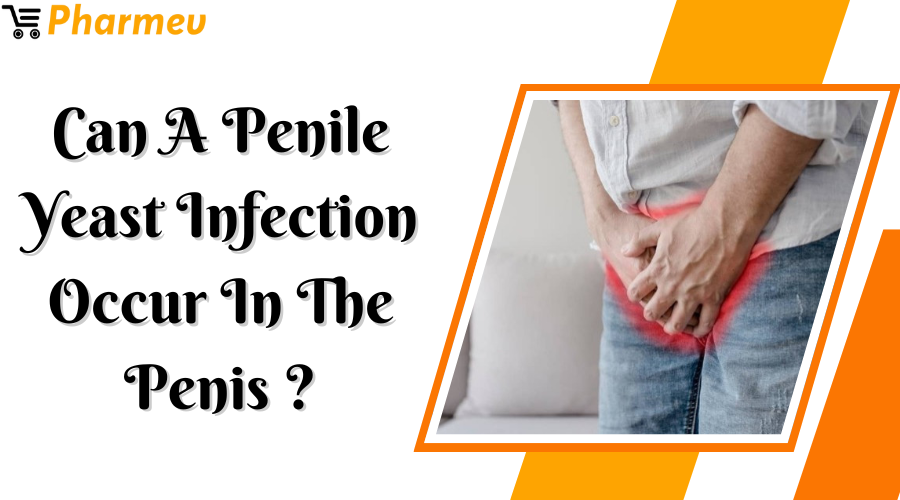 Can a Penile Yeast Infection Occur in the Penis